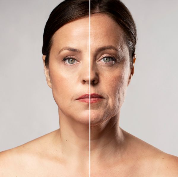 Before and after portrait of mature woman retouched depicting facial surgery